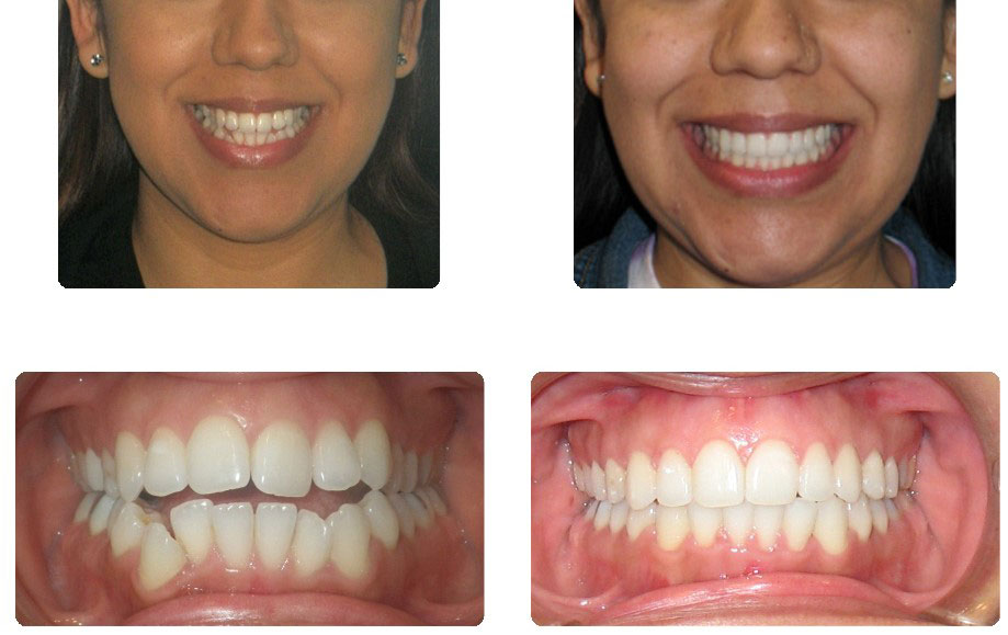 img-patient-before-and-after