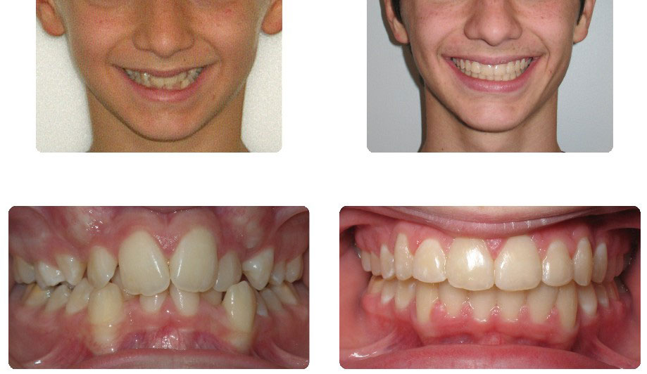 img-patient-before-and-after