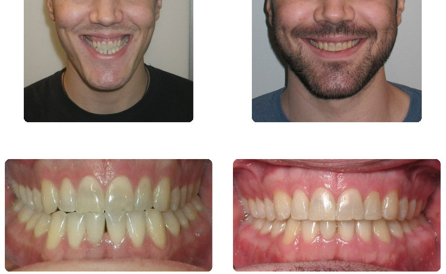 img-patient-before-and-after