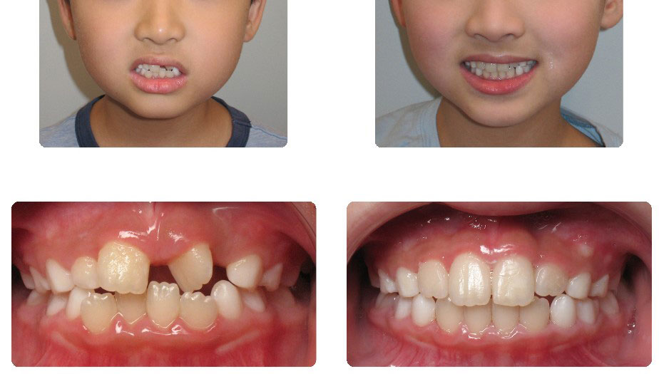 img-patient-before-and-after