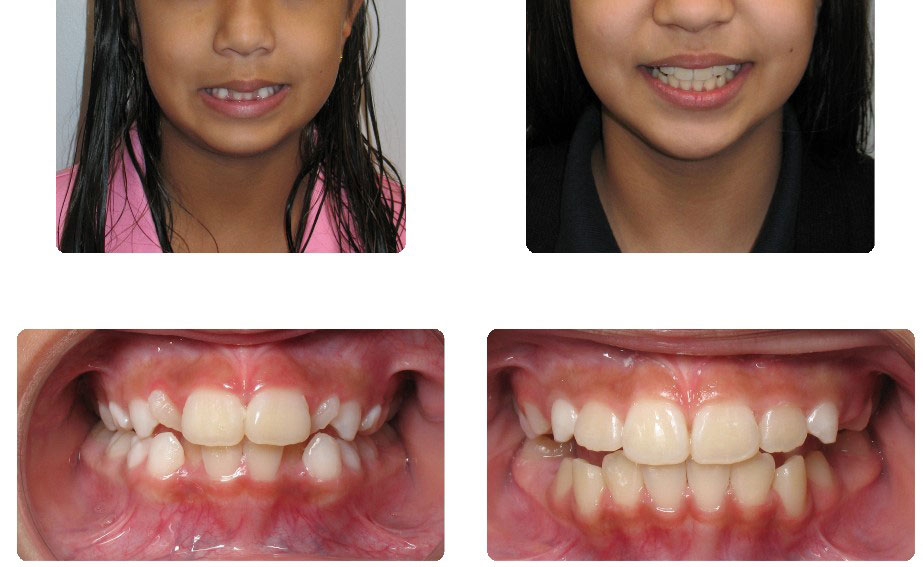 img-patient-before-and-after