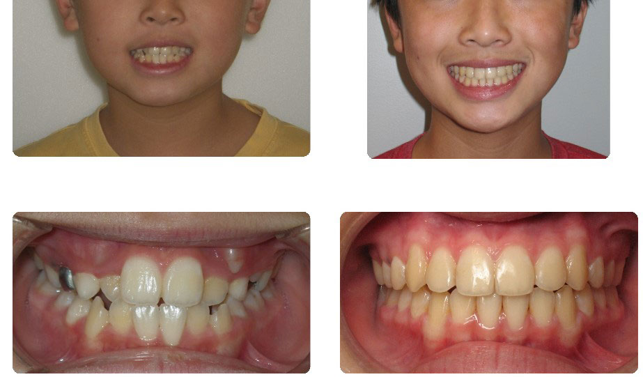 img-patient-before-and-after