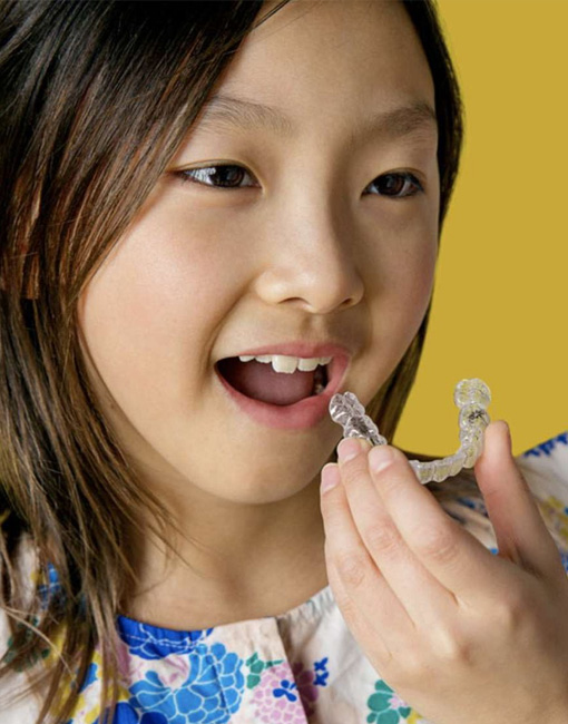 img-ser-invisalign-kids-01