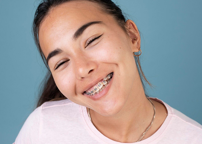 img-Overbite Correction 