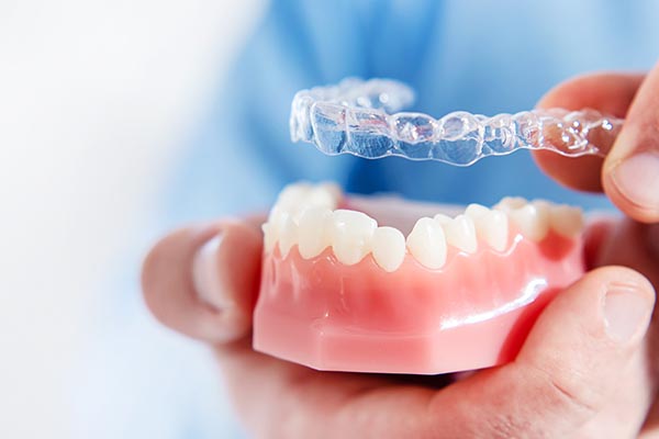 An Orthodontist Shares Reasons Clear Aligners May Be Right for You from Kathleen C. Hwang Orthodontics in Monrovia, CA